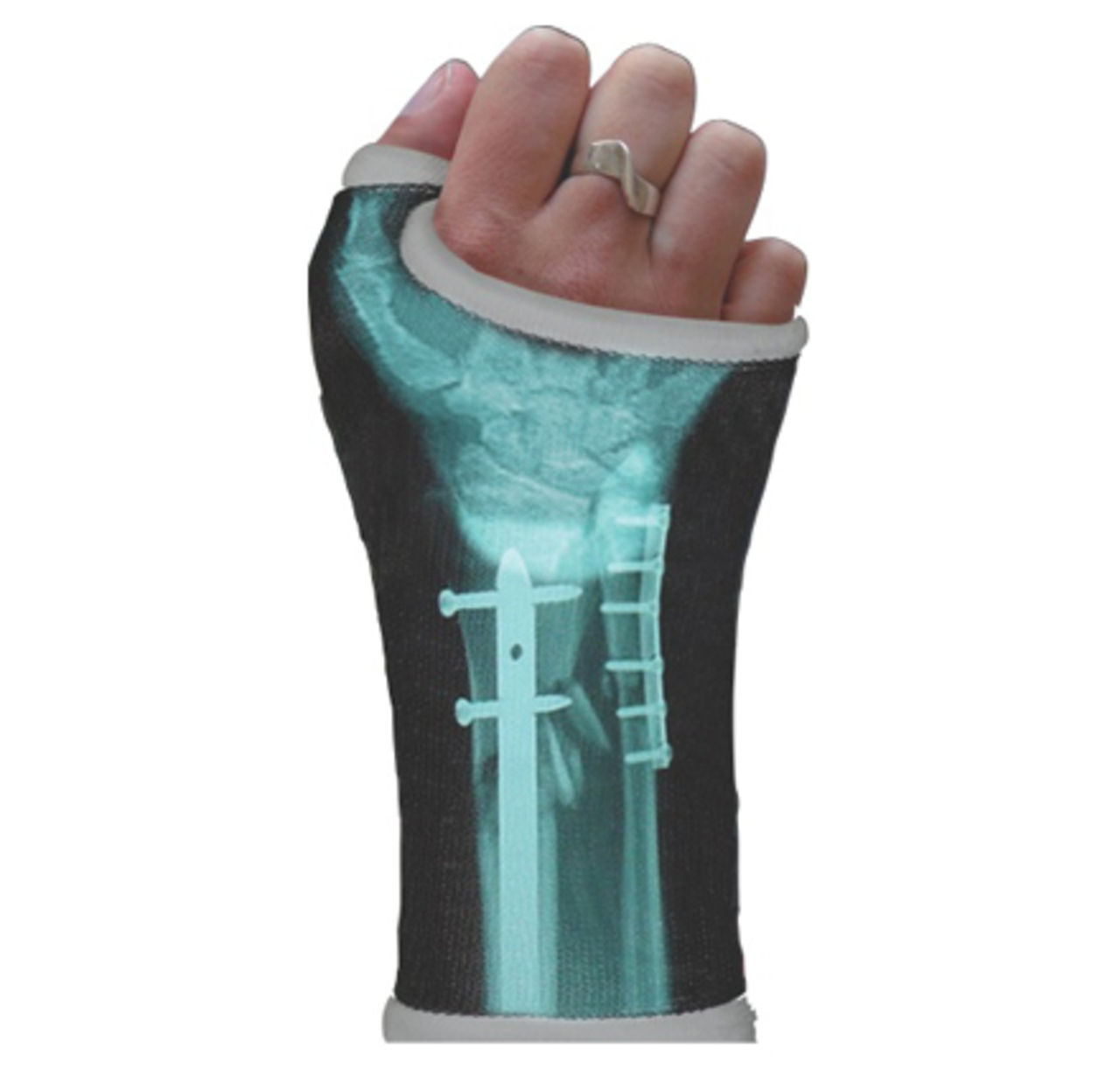 Castoo - lite roligare gips