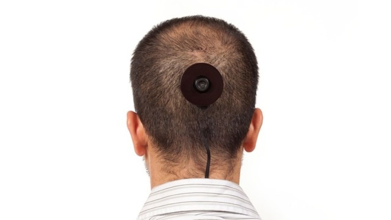 Att ha en kamera monterad i bakhuvudet är ingen bra idé