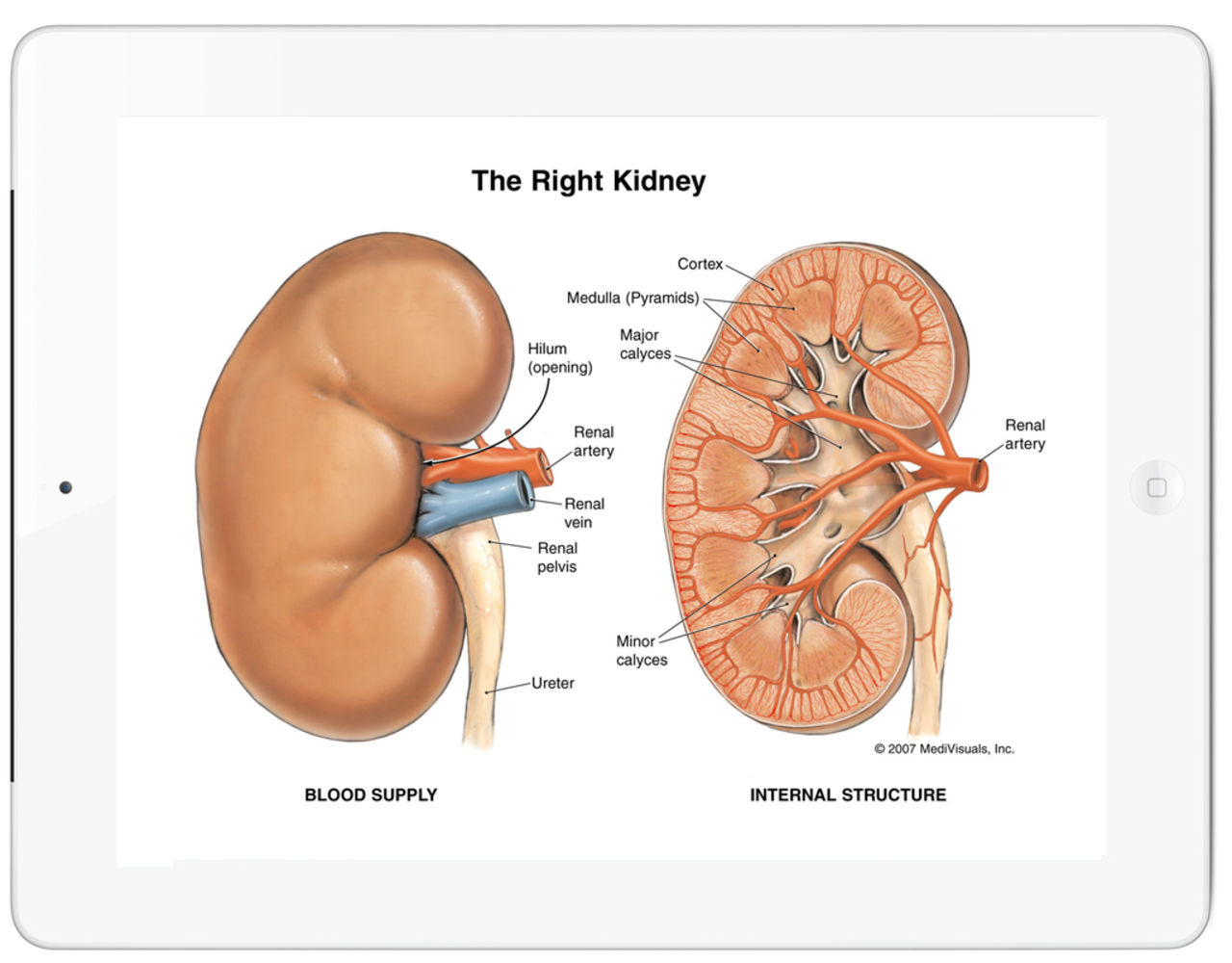 Kille sålde ena njuren för en iPad 2