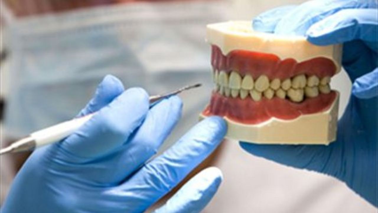 Käke utskriven i 3D inopererad i kvinnas mun