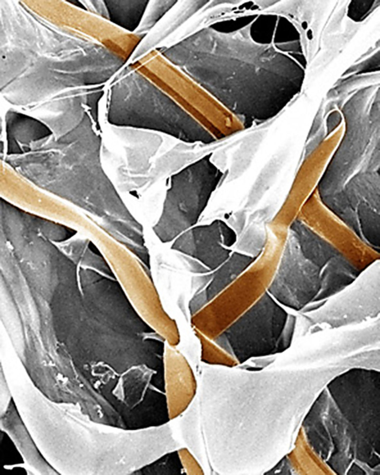 Cybervävnad håller koll på ditt hjärta