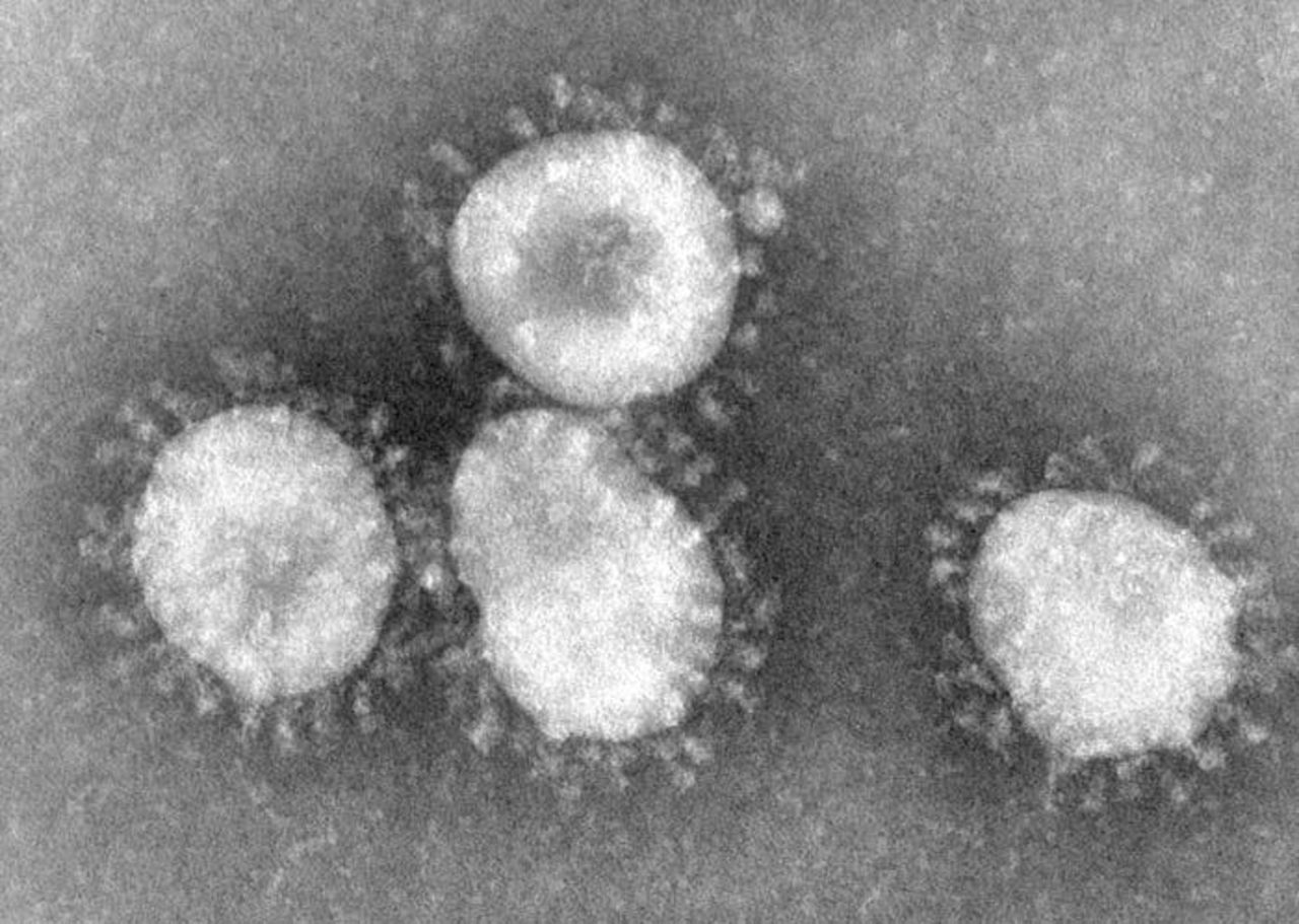 SARS-liknande virus upptäckt i mellanöstern