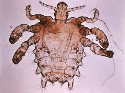 Tumnagel