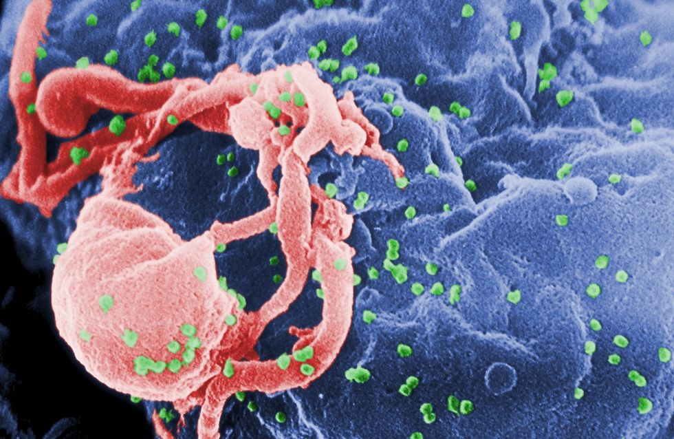 HIV-smittat barn i USA botades