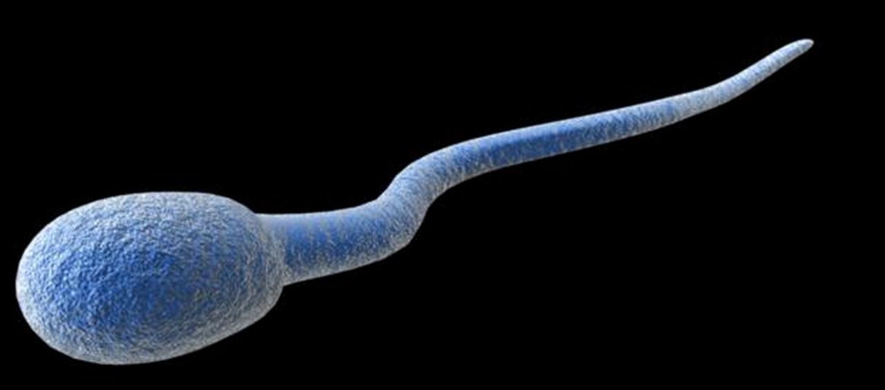 Kvinna gravid efter första lyckade livmodertransplantationen 