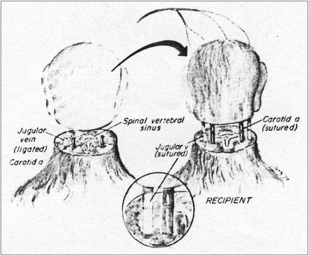 Tumnagel