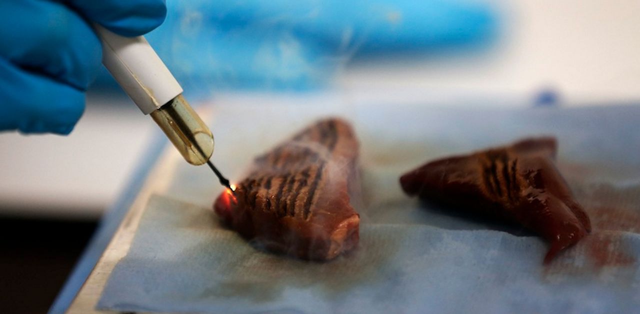 Intelligent skalpell kan hitta cancerceller 