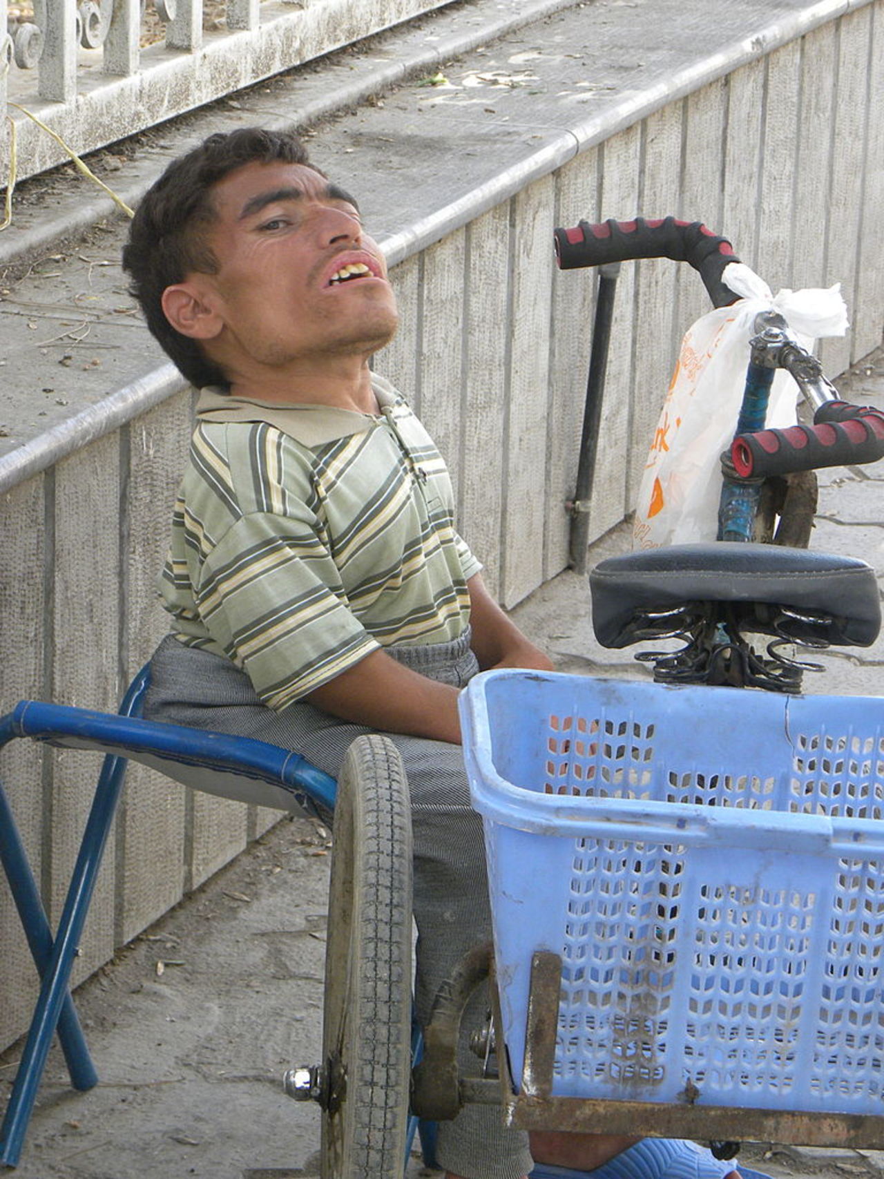 Protein kan förhindra kortväxthet