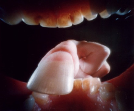 Tumnagel