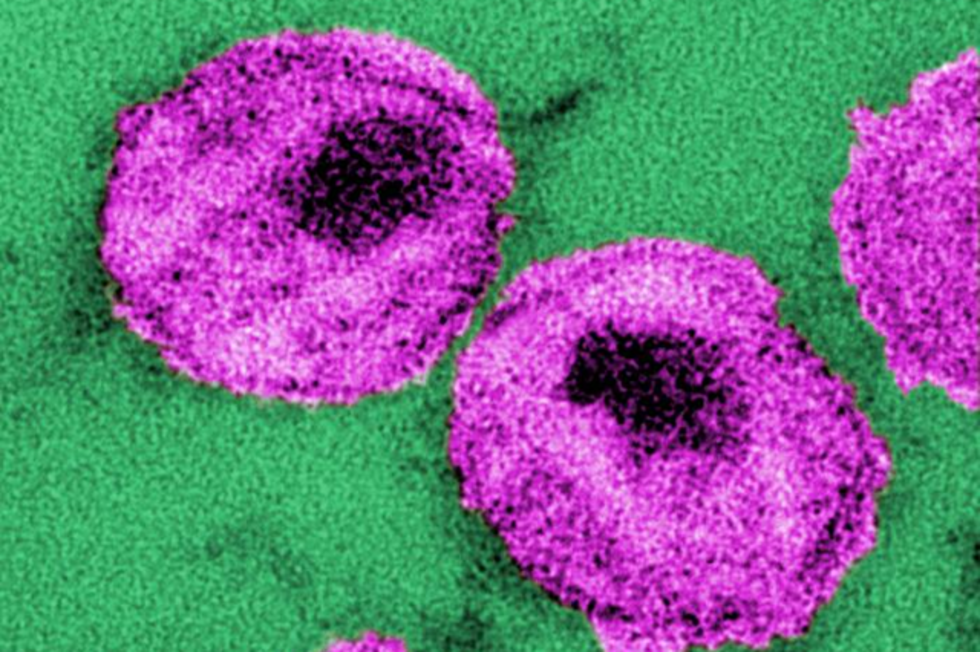 HIV smittas mellan två kvinnor