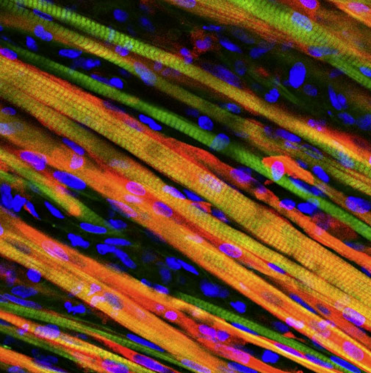Forskare lyckas ta fram konstgjord muskel som regenererar