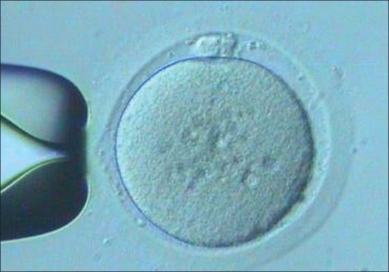 Apple och Facebook betalar kvinnliga anställda för att frysa ner sina ägg