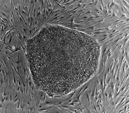 Tumnagel