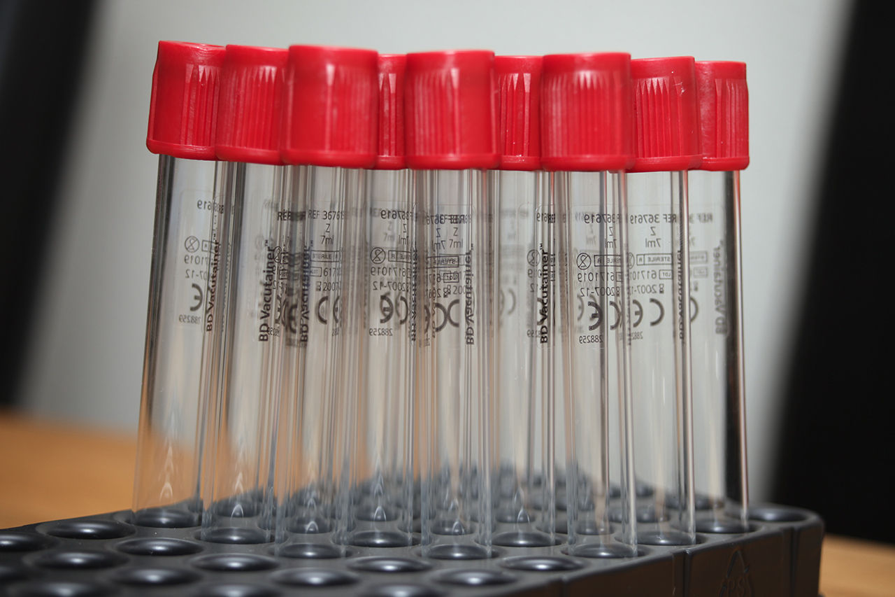 Storbritannien ska analysera 100.000 personers DNA