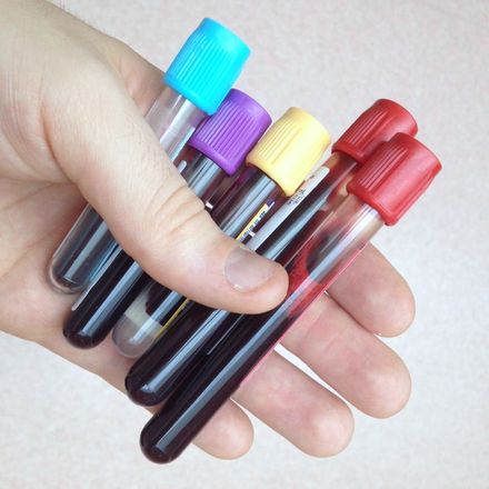 Tumnagel