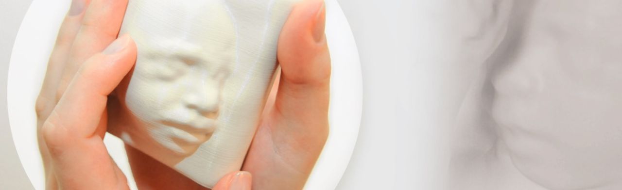 In Utero 3D tar fram 3D-ritningar på foster