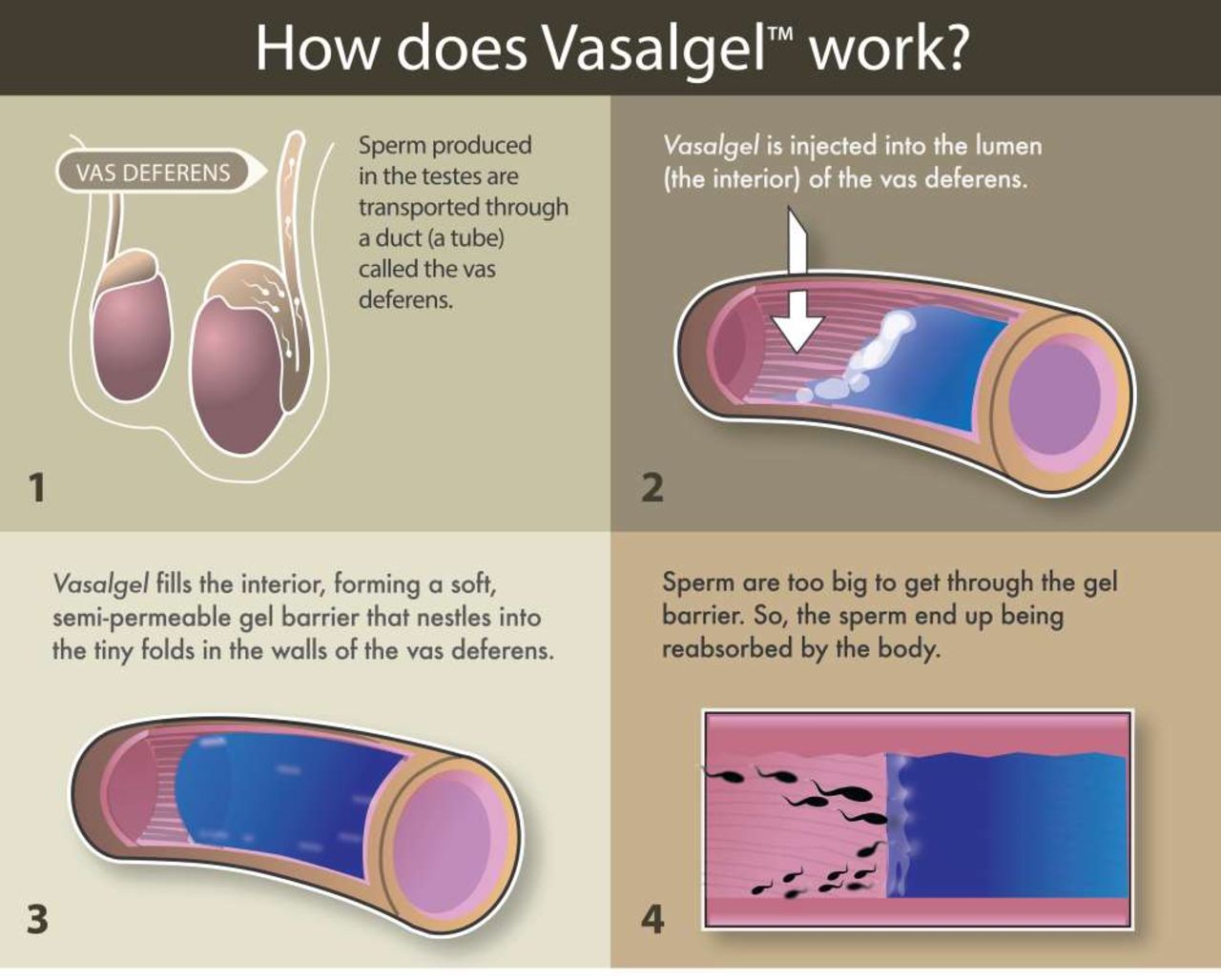 Vasalgel har testats som preventivmedel på apor