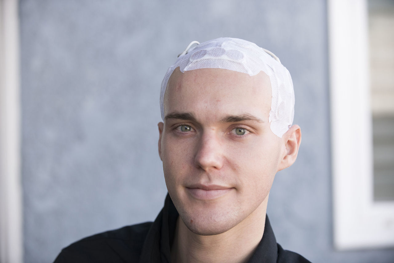 Elektrisk hjälm kan förlänga livet för människor med hjärncancer