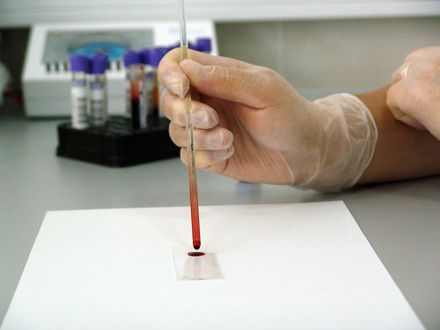 Tumnagel