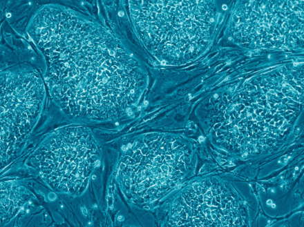 Tumnagel