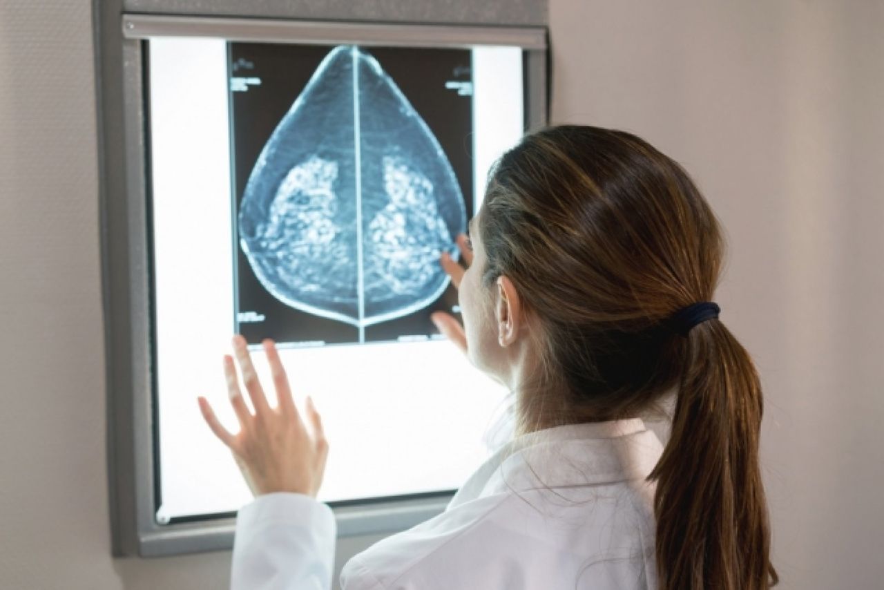 AI lika bra på att upptäcka risk för bröstcancer som en läkare