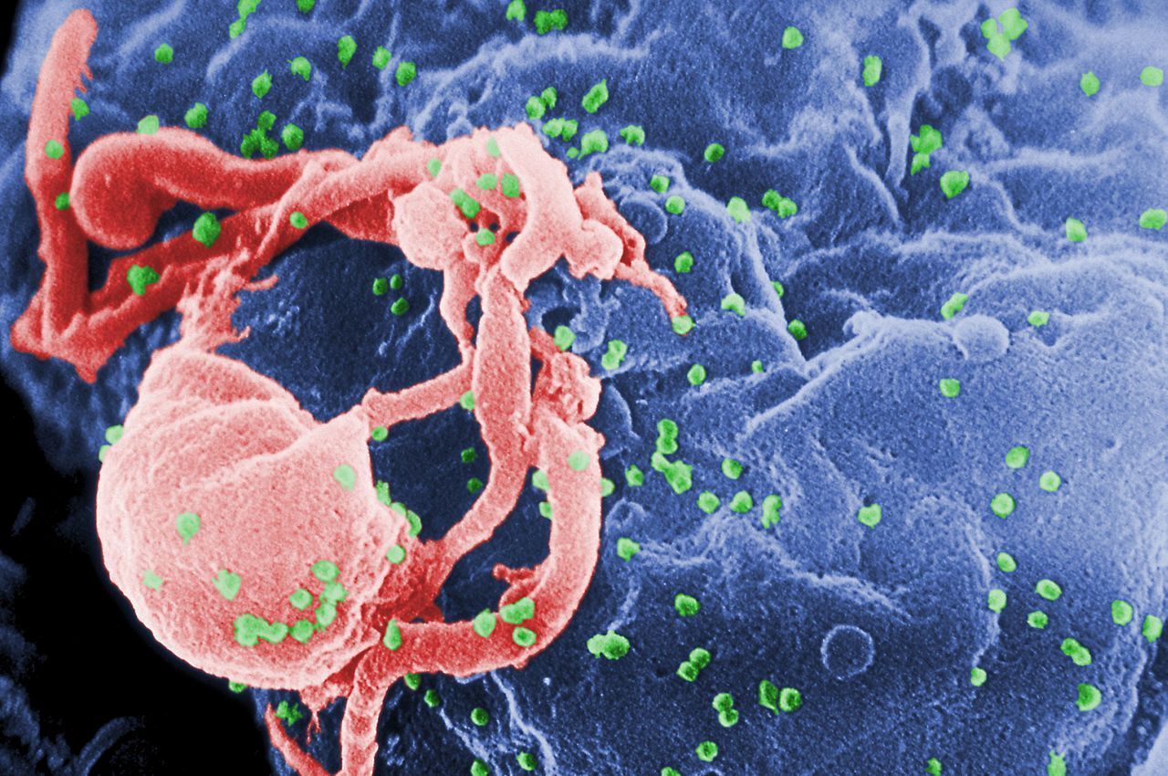 Brittisk man uppges ha blivit botad från HIV