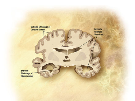 Tumnagel