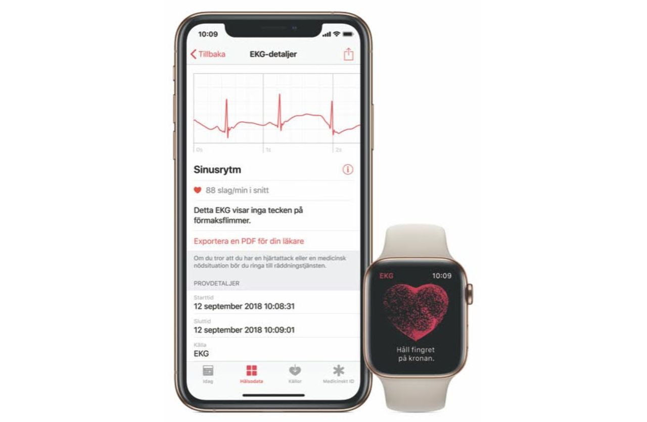 Nu finns EKG på Apple Watch även i Sverige