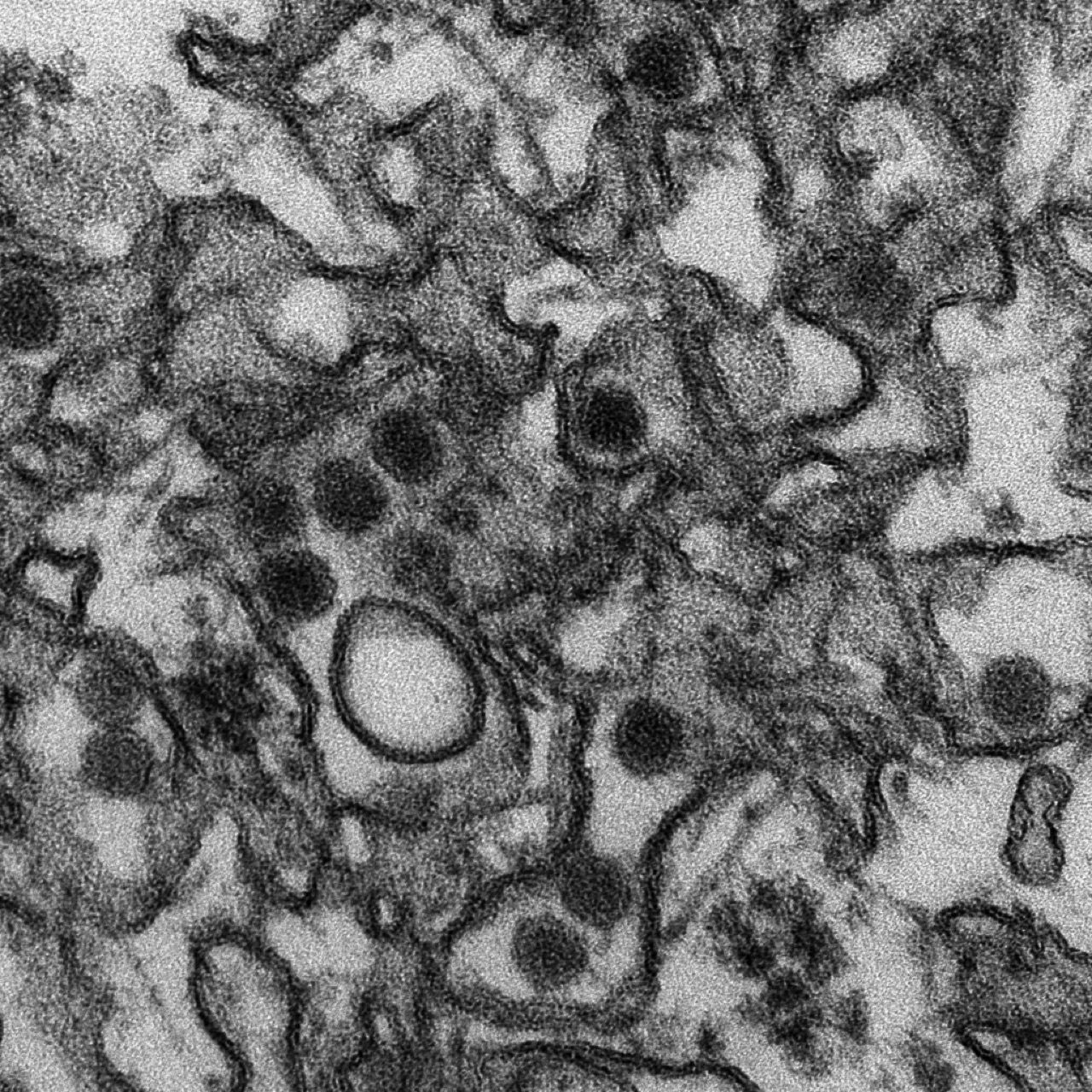 Zikavirus upptäckt i Frankrike