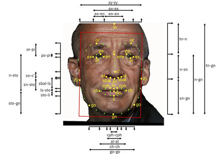 Tumnagel