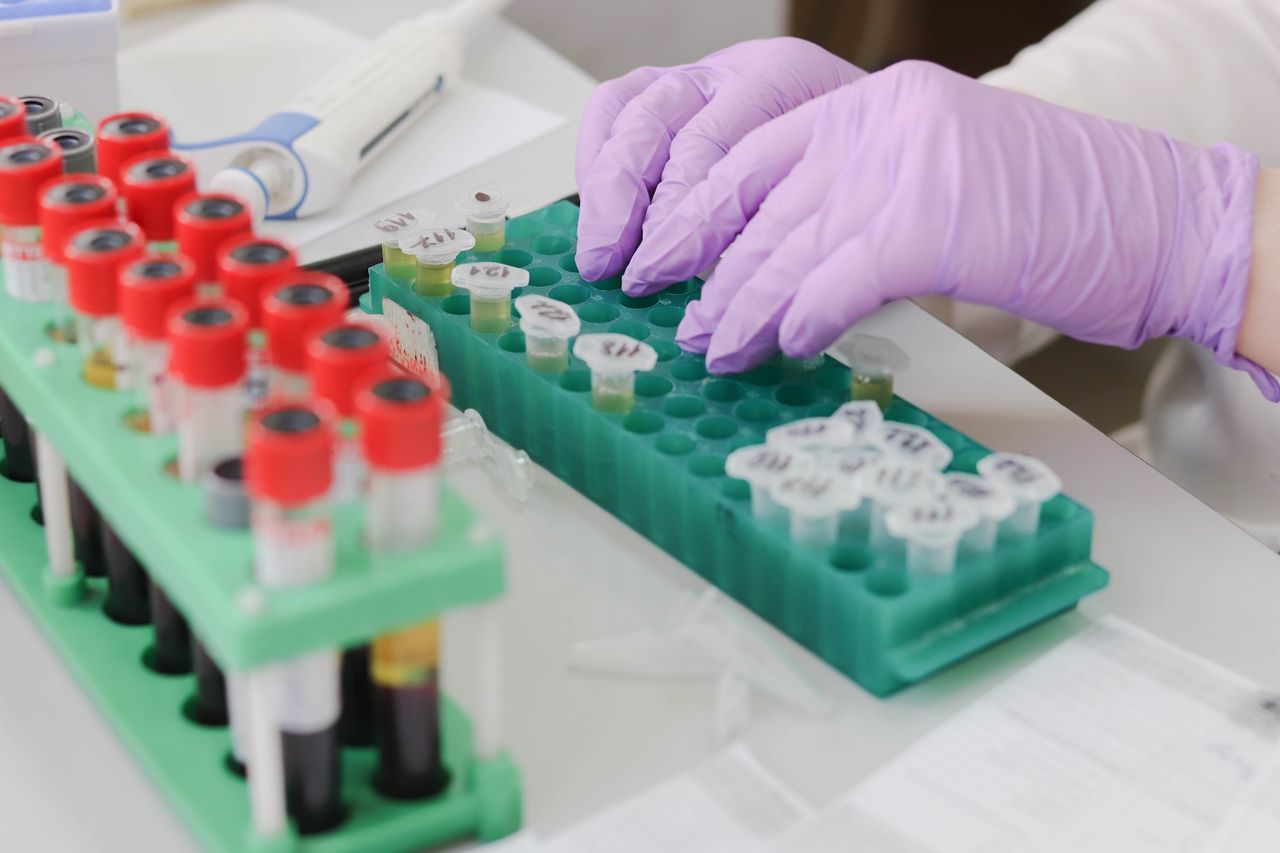 Karolinska institutet tar fram snabbare coronatest