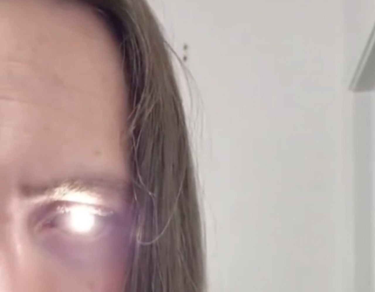 Snubbe har en ficklampa i ögat