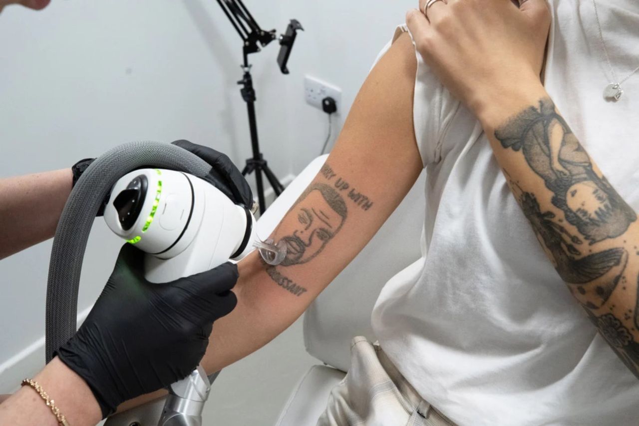 Företag erbjuder sig att ta bort Kanye West-tatueringar gratis