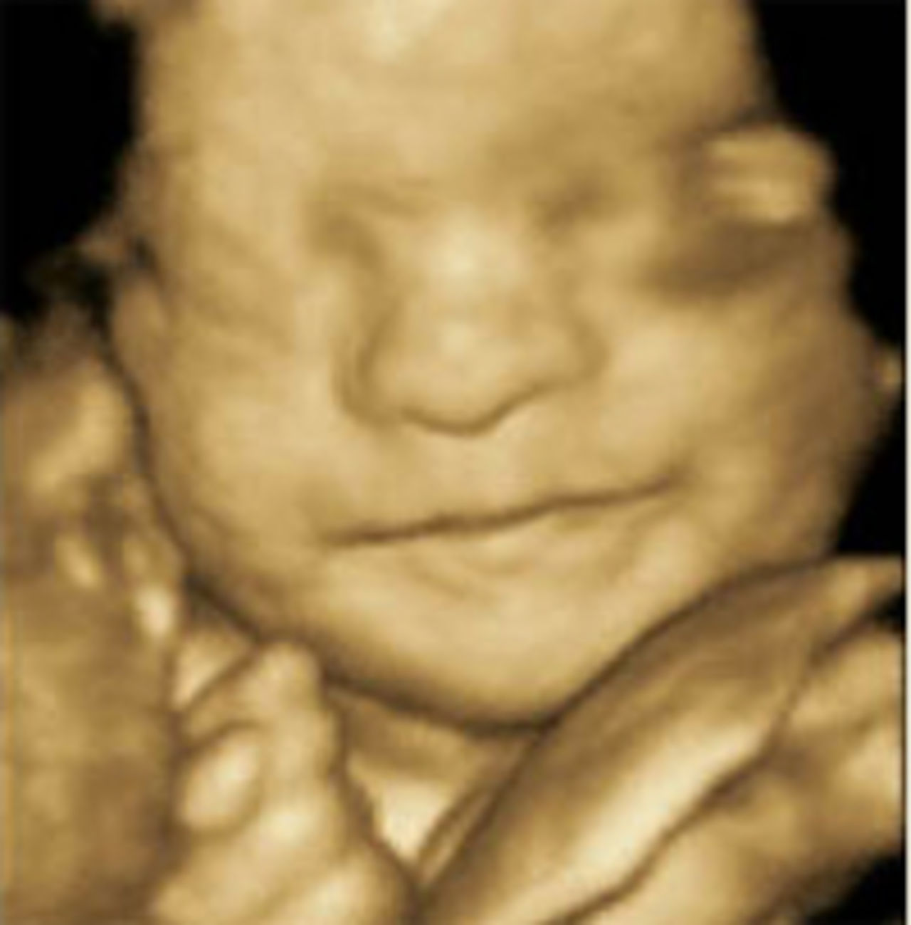 4D-ultraljudet är här!