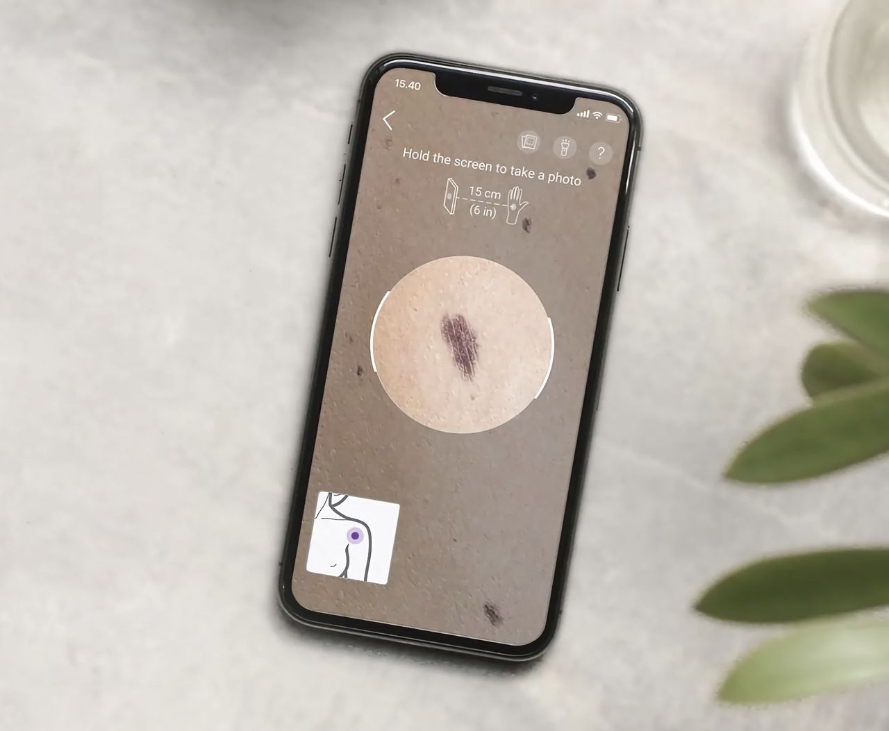 Läkare varnar för hudcancer-appar