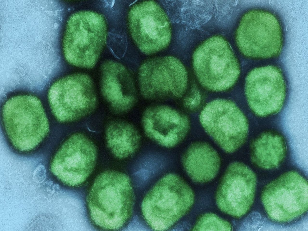 Folkhälsomyndigheten uppdaterar kring mpox