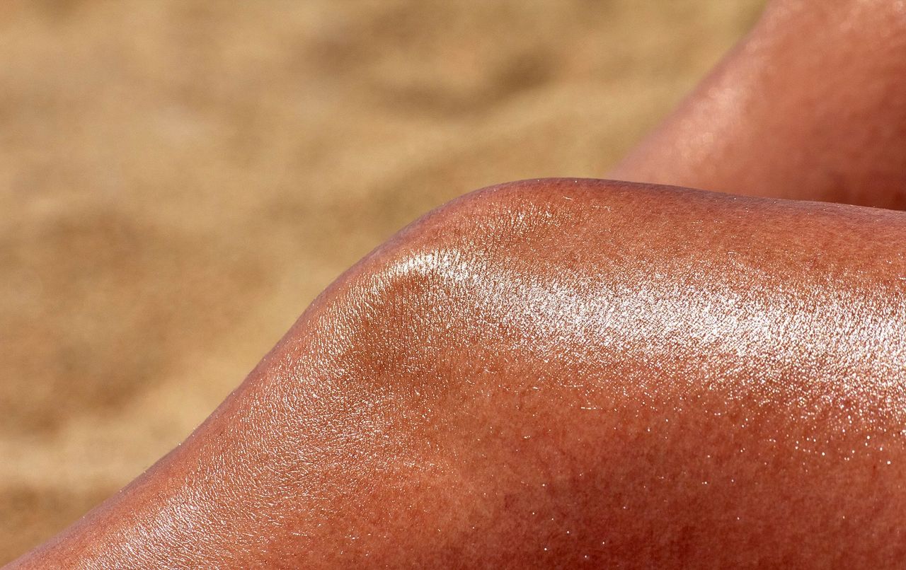 AI hjälper till att upptäcka hudcancer