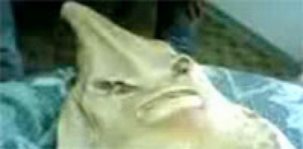 Tumnagel